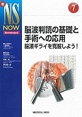 脳波判読の基礎と手術への応用　新NS　NOW7