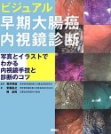 ビジュアル早期大腸癌内視鏡診断