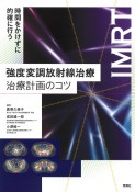 強度変調放射線治療治療計画のコツ　時間をかけずに的確に行う