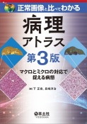 正常画像と比べてわかる病理アトラス　マクロとミクロの対比で捉える病態　第3版