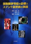 頸動脈狭窄症の診療とステント留置術の実際