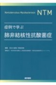 症例で学ぶ肺非結核性抗酸菌症