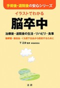 イラストでわかる　脳卒中　治療後・退院後の生活・リハビリ・食事　手術後・退院後の安心シリーズ