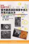 身につく　蛍光眼底造影検査手技と所見の読み方