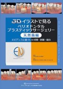 3Dイラストで見るペリオドンタルプラスティックサージェリー　天然歯編