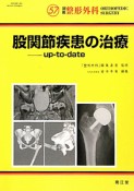 股関節疾患の治療　up－to－date