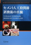 セメント人工股関節置換術の真髄