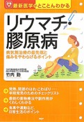 リウマチ・膠原病　最新医学がとことんわかる