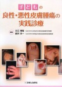 子どもの良性・悪性皮膚腫瘍の実践診療