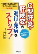 C型肝炎・肝硬変の進行・発病をストップ！