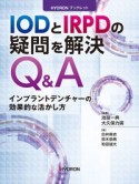 IODとIRPDの疑問を解決Q＆A　インプラントデンチャーの効果的な活かし方