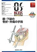 膝・下腿の骨折・外傷の手術　OS　NEXUS1