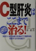 C型肝炎はここまで治る！