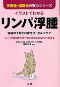 イラストでわかるリンパ浮腫　手術後・退院後の安心シリーズ