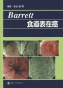 Barrett　食道表在癌