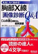 胸部X線　画像診断Q＆A　見逃しなく読める！