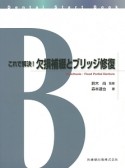 これで解決！欠損補綴とブリッジ修復