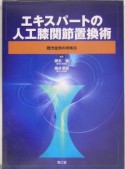 エキスパートの人工膝関節置換術