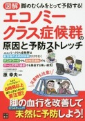 図解・エコノミークラス症候群の原因と予防ストレッチ