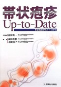 帯状疱疹Up－to－Date