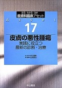 皮膚の悪性腫瘍　実践に役立つ最新の診断・治療　皮膚科臨床アセット17