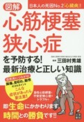 図解　心筋梗塞・狭心症を予防する！最新治療と正しい知識