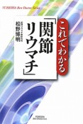 これでわかる「関節リウマチ」