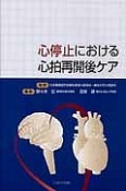 心停止における心拍再開後ケア