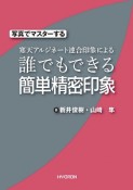 写真でマスターする　寒天アルジネート連合印象による　誰でもできる簡単精密印象