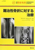 難治性骨折に対する治療