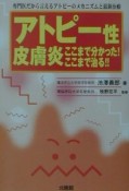 アトピー性皮膚炎ここまで分かった！ここまで治る！！