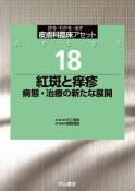 紅斑と痒疹　病態・治療の新たな展開　皮膚科臨床アセット18