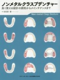 ノンメタルクラスプデンチャー