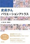 皮膚がんバリエーションアトラス