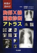 胸部X線画像診断アトラス　疾患が読める！