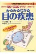 みるみるわかる　目の疾患　一歩先ゆく眼科スタッフシリーズ2