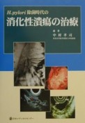 H．pylori除菌時代の消化性潰瘍の治療