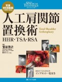 人工肩関節置換術　HHR・TSA・RSA