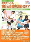 写真でわかる重症心身障害児（者）のケア