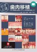 必ず上達　歯肉移植　FGG（遊離歯肉移植術）＆CTG（結合組織移植術）入門