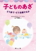 子どものあざ　どう診て・どう治療するか