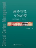 歯を守るう蝕治療　非切削う蝕治療へのパラダイムシフト