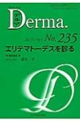 Derma．　2015．9　エリテマトーデスを診る（235）