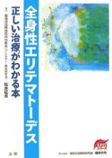 全身性エリテマトーデス