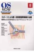 OS　NOW　Instruction－整形外科手術の新標準－　スポーツによる膝・足関節靱帯損傷の治療　標準および応用手技のコツ＆トラブルシューティング　DVD付（8）