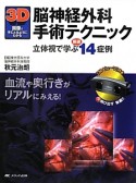 3D画像で手にとるようにわかる脳神経外科手術テクニック