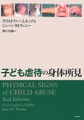 子ども虐待の身体所見