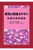 悪性と間違えやすい乳腺の良性病変