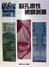 ES　Now　illustrated　裂孔原性網膜剥離　no．7