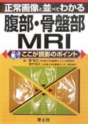 腹部・骨盤部MRI　ここが読影のポイント